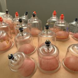 Cupping