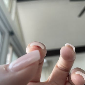 Fendy Nail Lounge - The skin that he pulled from old acrylic inside my nail it has still a little blood on it - Nail Salons Near Me - Cypress, California