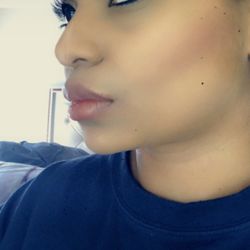 S Aesthetics MD - I got one syringe lip filler which I think was a great choice (1 day after filler was put in)