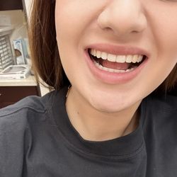 DesignerSmiles Orthodontics - North Hollywood