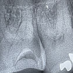 Magic Touch Dentistry - X-rays taken at the above location