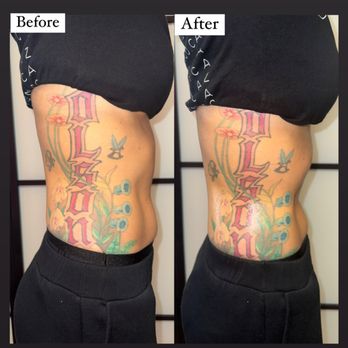 Snatched562 - Body Contouring Near Me - Long Beach, California Snatched562 - Body Contouring Near Me - Long Beach, California
