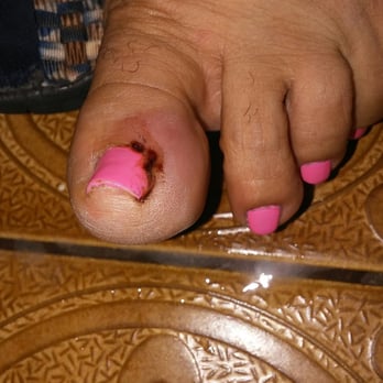 C & T Nails - went to get pedicures here and my moms big toe got very Infected and Swollen. my moms toe is still bleeding. - Nail Salons Near Me - Montebello, California C & T Nails - went to get pedicures here and my moms big toe got very Infected and Swollen. my moms toe is still bleeding. - Nail Salons Near Me - Montebello, California