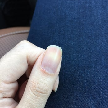 Queen Nails - Not a lot of blood but it hurts! - Nail Salons Near Me - Los Angeles, California Queen Nails - Not a lot of blood but it hurts! - Nail Salons Near Me - Los Angeles, California