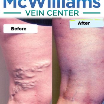 McWilliams Vein Center - Family Practice Near Me - Wheaton, Illinois