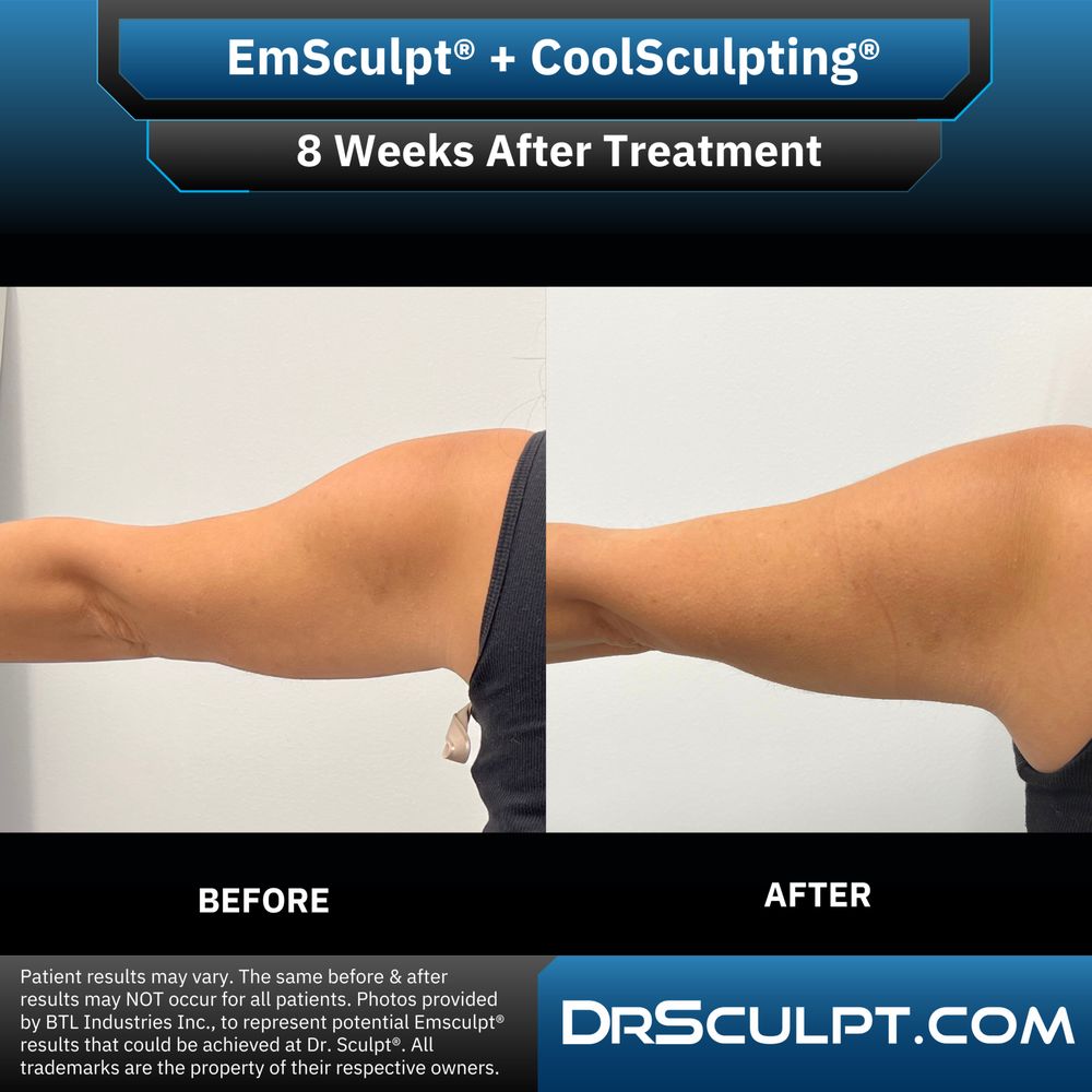 Dr. Sculpt CoolSculpting & EmSculpt Center Logo