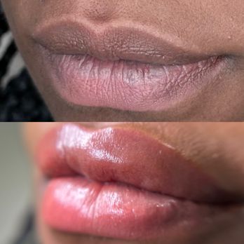Inka Fina - Lip neutralization! - Permanent Makeup Near Me - Woodbridge, Virginia Inka Fina - Lip neutralization! - Permanent Makeup Near Me - Woodbridge, Virginia