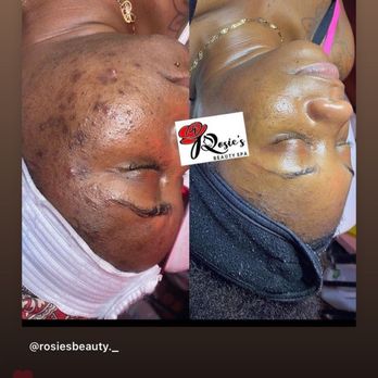 Rosies Beauty Spa - Skin Care Near Me - Arlington, Texas Rosies Beauty Spa - Skin Care Near Me - Arlington, Texas