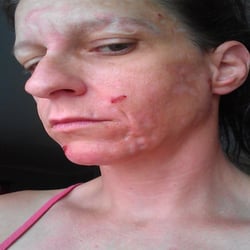 Balanced Skin Care Center