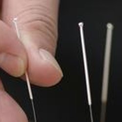 Red Aspen Acupuncture