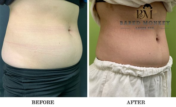 Bared Monkey Laser Spa by null