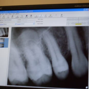 Robert F Murray, DDS - My Tooth! - Cosmetic Dentists Near Me - Aliso Viejo, California