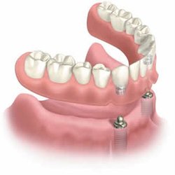 Burnside Denture Clinic