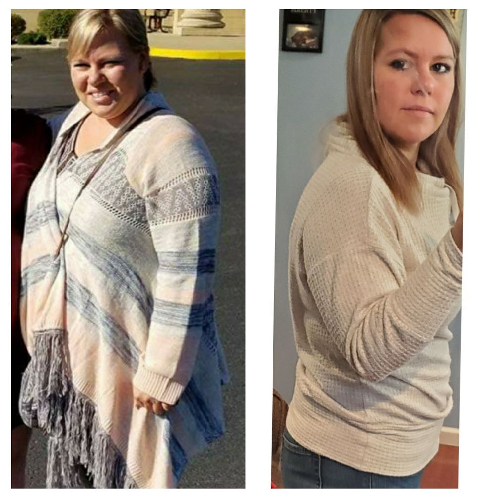 INSPIRE WEIGHT LOSS Updated September 2024 Request an Appointment