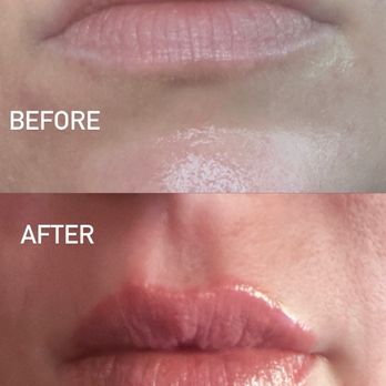 Morpheus Medical Aesthetics - Medical Spas Near Me - Santa Rosa, California Morpheus Medical Aesthetics - Medical Spas Near Me - Santa Rosa, California