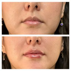 O'Life - Lips! Just shape !
