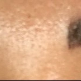 Beauty Sketch - Two days after first session - Permanent Makeup Near Me - Honolulu, Hawaii Beauty Sketch - Two days after first session - Permanent Makeup Near Me - Honolulu, Hawaii