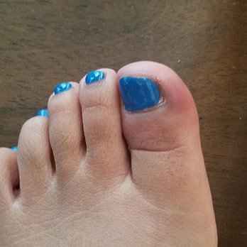 Friendly Nails - This was my toe. It was purple and hurting. Never going back. - Nail Salons Near Me - South Gate, California Friendly Nails - This was my toe. It was purple and hurting. Never going back. - Nail Salons Near Me - South Gate, California