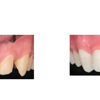 Spectrum Dental - Pediatric Dentists Near Me - Baltimore, Maryland Spectrum Dental - Pediatric Dentists Near Me - Baltimore, Maryland