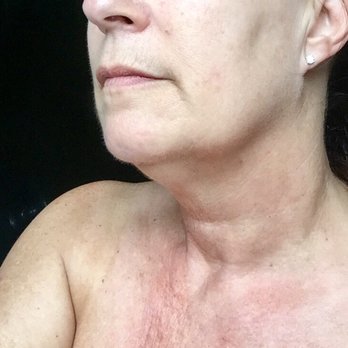 Soleil Airbrush Tanning - Before - Spray Tanning Near Me - Oklahoma City, Oklahoma