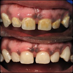 Empower Dental