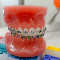 Hook Orthodontics - Traditional braces