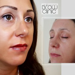 National Brow Clinic