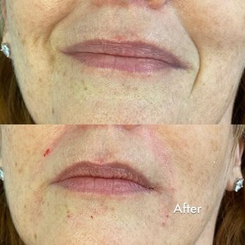 Flawless Aesthetics - Weight Loss Centers Near Me - Columbus, Georgia Flawless Aesthetics - Weight Loss Centers Near Me - Columbus, Georgia