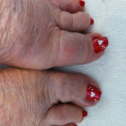 Kat's Klaws by Katerina - Valentine's day toes