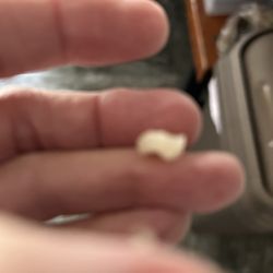Advanced Dentistry by Design - My crown