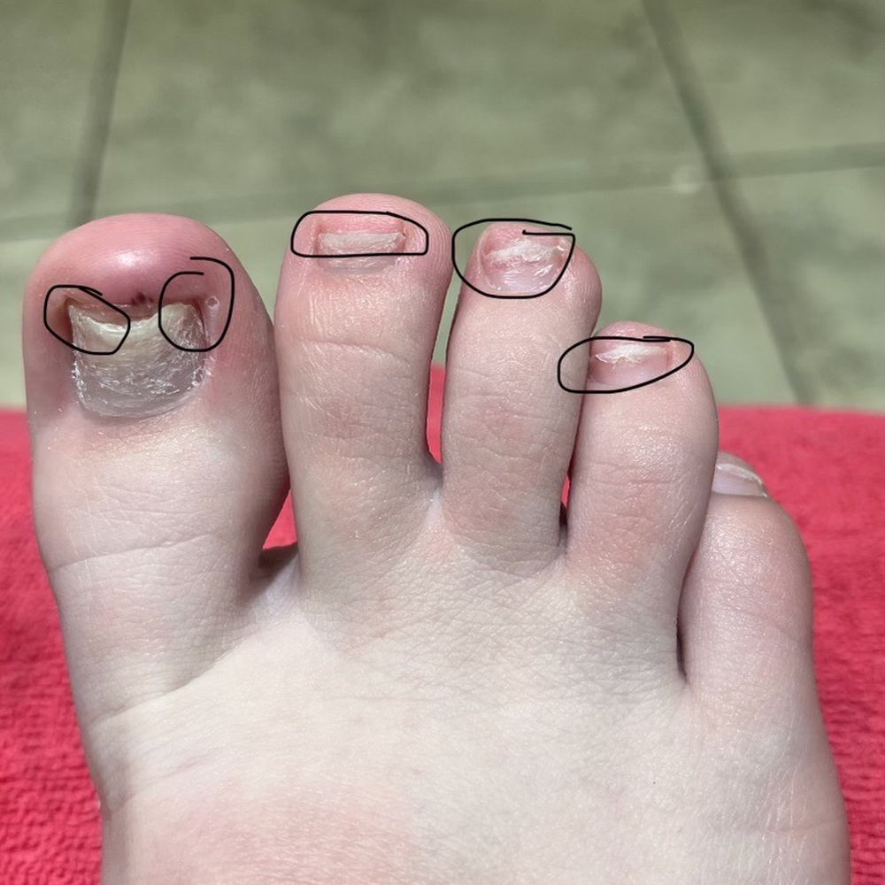 H Nails & Bar - Worse pedicure ever. - Nail Salons Near Me - San Antonio, Texas