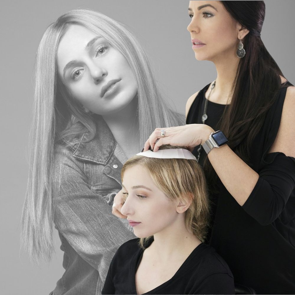 Advanced Hair Aesthetics/ San Diego Hair Loss Specialist — hair transplant clinic in Del Mar, CA