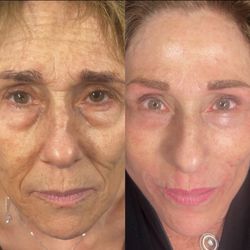 Elavine Microblading - I did permanent brows, lips and eyeliner also plasma fibroblast