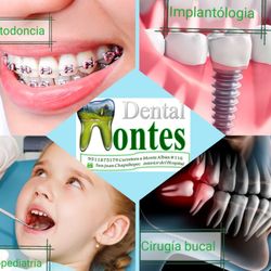 Dental Montes - Te ofrecemos una completa atención con el mejor trato humano.