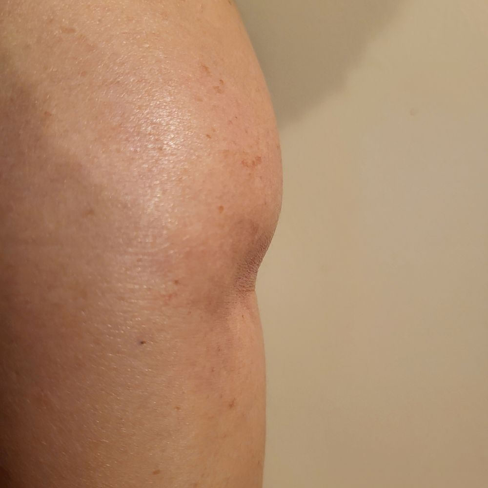 THE BEST 10 Orthopedic Doctor in Mountain View, CA - Updated 2026 - Quality  & Affordability - Yelp