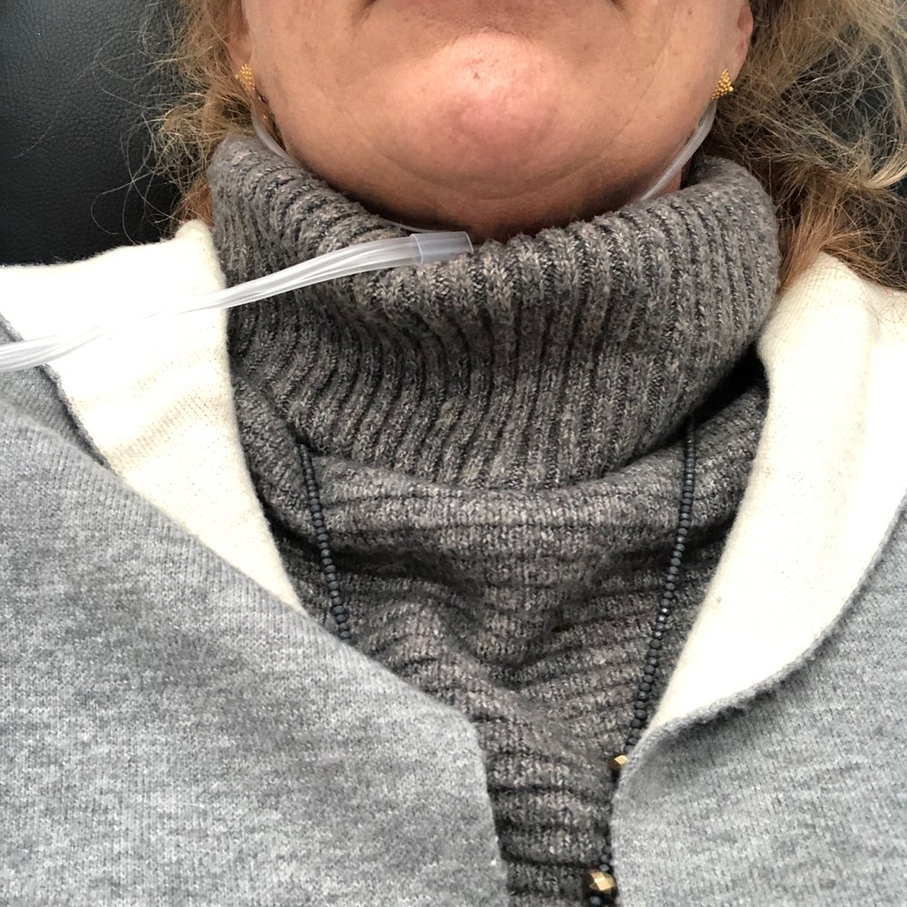 I was nervous to fill in my thinning lips because I did not want the duck lips. Aminda plumped them just so. They look so natural! I was nervous to fill in my thinning lips because I did not want the duck lips. Aminda plumped them just so. They look so natural!