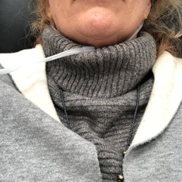 I was nervous to fill in my thinning lips because I did not want the duck lips. Aminda plumped them just so. They look so natural! I was nervous to fill in my thinning lips because I did not want the duck lips. Aminda plumped them just so. They look so natural!