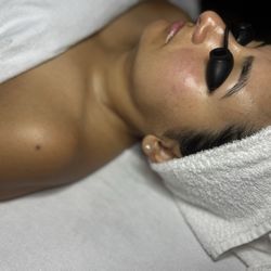 Dermaplane facial after glow