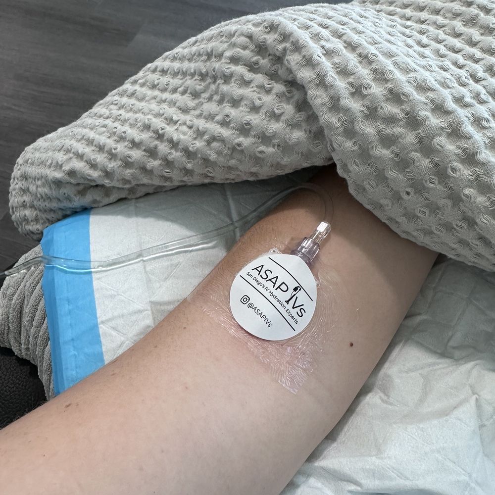 ASAP IVs - IV Hydration Near Me - Encinitas, California