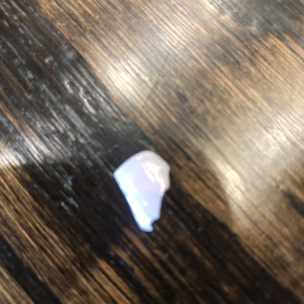Top Style Nails Spa - Gel tip that took half my nail with it. showed this to the girl at front desk so she could see they were breaking off in chunks. - Nail Salons Near Me - Clifton, New Jersey
