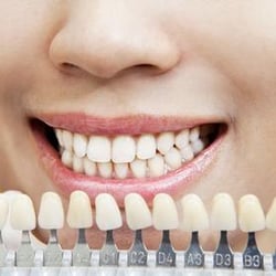 Quality Dental Care - Quality Dental Care, P.C. | Hopewell Junction, NY