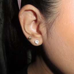 With earrings after surgery