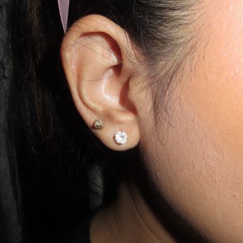 PlasticsMD - With earrings after surgery - Plastic Surgeons Near Me - Huntington Beach, California