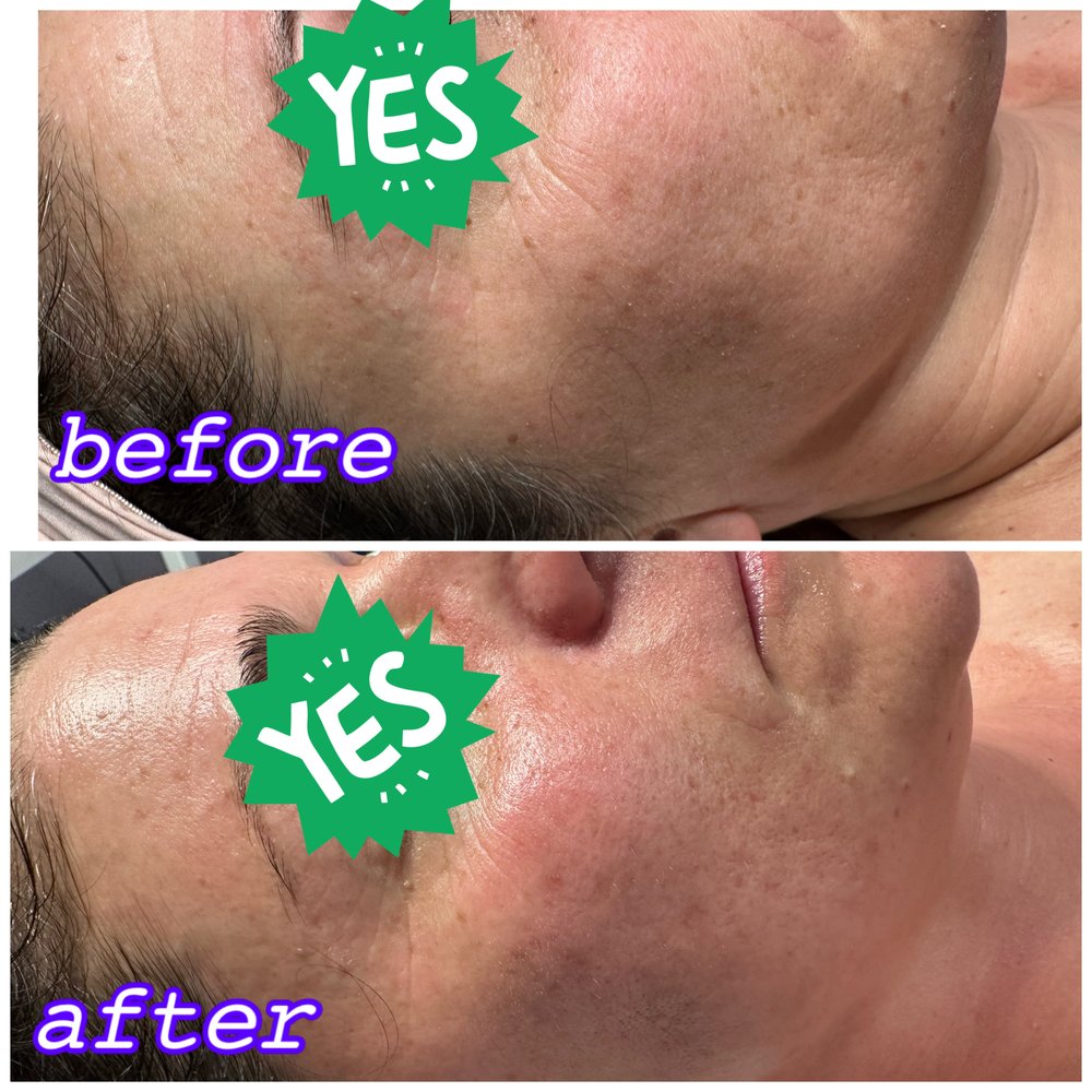 LISA NADLER SKIN CARE 49 Photos & 20 Reviews 1979 E 17th St, Santa