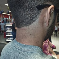 Neck is cut up