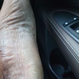 1 day after getting a pedicure for $36 this is how my feet looks. A picture is worth a 1000 words. Unfriendly and poor work!