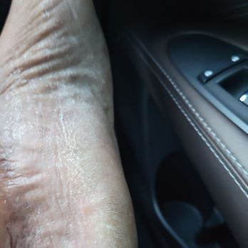 Dip Nail Bar Suwanee - 1 day after getting a pedicure for $36 this is how my feet looks. A picture is worth a 1000 words. Unfriendly and poor work! - Nail Salons Near Me - Suwanee, Georgia