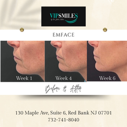 VIP Smiles by Dr Julie Molin - ::NEW:: non invasive esthetic services! No needles, no pain, NO DOWNTIME!