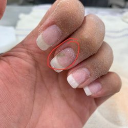 Healthy Nails Encino - Green mold that grew on my nail from poor application and unsanitary tools
