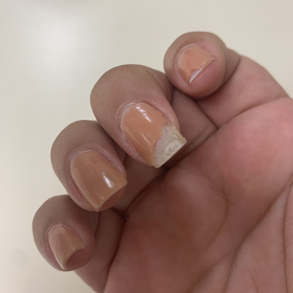 Lee's Nail & Spa - After 2 days my nails where chipping and dip powder is still on. - Nail Salons Near Me - Pasadena, California Lee's Nail & Spa - After 2 days my nails where chipping and dip powder is still on. - Nail Salons Near Me - Pasadena, California